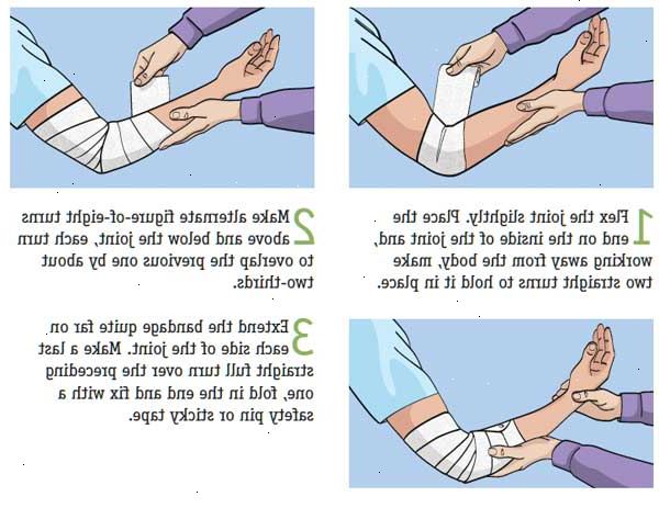 Hvordan til at anvende forskellige typer af bandager. Forsøge at vurdere sværhedsgraden af såret.