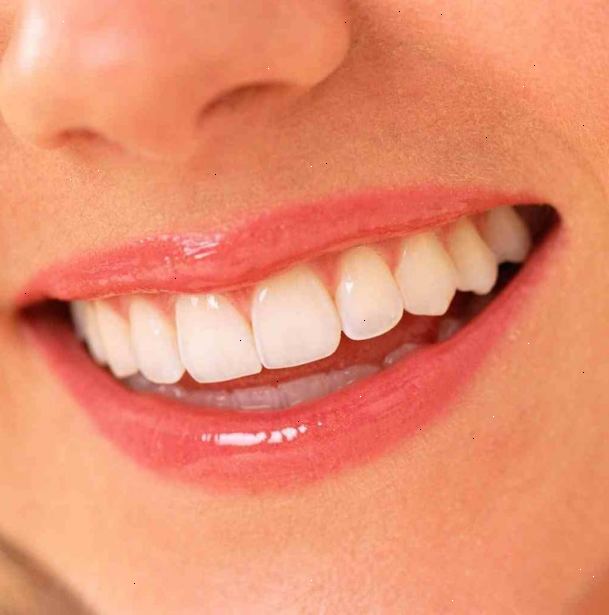 Hvordan man har rene, hvide tænder. Skylle munden med koldt vand i cirka 30 sekunder til at slippe af eventuelle løse snavs mellem tænderne.