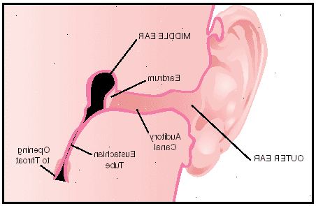 Hvordan til at lindre øre overbelastning. Fastslå årsagen til øret overbelastning.