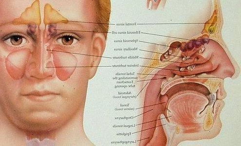 Hvordan til at frigive sinus pres. Holde luften fugtig til at hjælpe smøre dine bihuler.